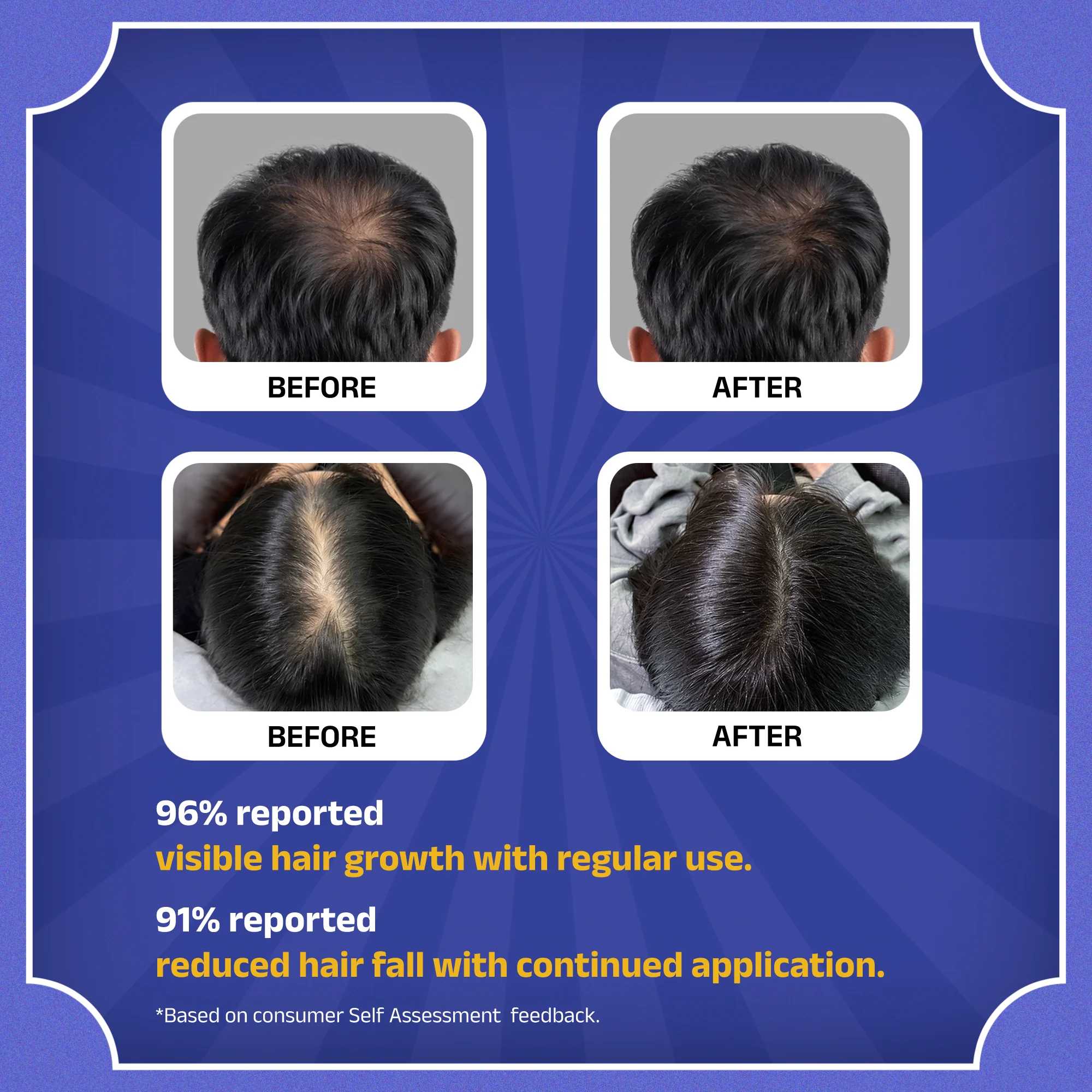 Rockstar Advanced Hair Growth Serum - Image 9